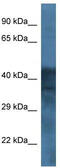 Gamma-aminobutyric acid receptor subunit beta-1 antibody, TA329170, Origene, Western Blot image 