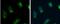 Acyl-CoA Synthetase Long Chain Family Member 4 antibody, NBP2-16400, Novus Biologicals, Immunofluorescence image 
