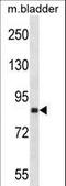 Discoidin Domain Receptor Tyrosine Kinase 2 antibody, LS-C164363, Lifespan Biosciences, Western Blot image 