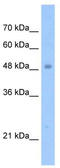 Tigger Transposable Element Derived 3 antibody, TA330966, Origene, Western Blot image 