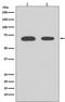 Checkpoint Kinase 2 antibody, M00277, Boster Biological Technology, Western Blot image 
