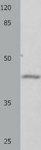 G Protein Subunit Alpha 11 antibody, TA323062, Origene, Western Blot image 