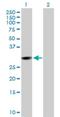 Carboxymethylenebutenolidase Homolog antibody, H00134147-B01P, Novus Biologicals, Western Blot image 