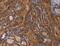 MAGE Family Member B10 antibody, MBS2518274, MyBioSource, Immunohistochemistry paraffin image 