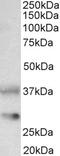 Keratin 13 antibody, 46-751, ProSci, Enzyme Linked Immunosorbent Assay image 