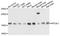 Hippocalcin Like 1 antibody, A08911, Boster Biological Technology, Western Blot image 