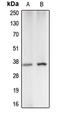 Carbonic Anhydrase 5A antibody, LS-C351888, Lifespan Biosciences, Western Blot image 