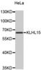 Kelch Like Family Member 15 antibody, abx004716, Abbexa, Western Blot image 