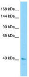 Centrosomal Protein 120 antibody, TA331314, Origene, Western Blot image 