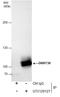 DNA Methyltransferase 3 Beta antibody, GTX129127, GeneTex, Immunoprecipitation image 