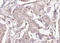 Protein Phosphatase 1 Regulatory Inhibitor Subunit 1B antibody, GTX00803, GeneTex, Immunohistochemistry paraffin image 