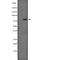 TGF-Beta Activated Kinase 1 (MAP3K7) Binding Protein 3 antibody, abx147063, Abbexa, Western Blot image 