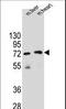 Potassium Channel Tetramerization Domain Containing 8 antibody, LS-C165463, Lifespan Biosciences, Western Blot image 