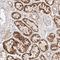 Mitogen-Activated Protein Kinase 6 antibody, HPA030262, Atlas Antibodies, Immunohistochemistry paraffin image 
