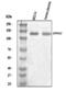 EPH Receptor A3 antibody, A02872-1, Boster Biological Technology, Western Blot image 