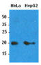 ADP Ribosylation Factor 1 antibody, AM09395PU-S, Origene, Western Blot image 