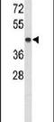 Potassium Channel Tetramerization Domain Containing 12 antibody, PA5-26281, Invitrogen Antibodies, Western Blot image 