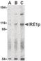 Endoplasmic Reticulum To Nucleus Signaling 1 antibody, LS-C19555, Lifespan Biosciences, Western Blot image 
