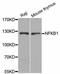 Nuclear Factor Kappa B Subunit 1 antibody, A6667, ABclonal Technology, Western Blot image 