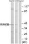 Ribosomal Modification Protein RimK Like Family Member B antibody, PA5-39428, Invitrogen Antibodies, Western Blot image 