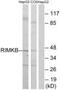 Ribosomal Modification Protein RimK Like Family Member B antibody, PA5-39428, Invitrogen Antibodies, Western Blot image 