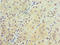 Alanyl-TRNA Synthetase 2, Mitochondrial antibody, LS-C377713, Lifespan Biosciences, Immunohistochemistry paraffin image 