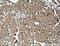 Ethylmalonyl-CoA Decarboxylase 1 antibody, 27732-1-AP, Proteintech Group, Immunohistochemistry paraffin image 