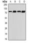 Myotubularin Related Protein 14 antibody, abx141991, Abbexa, Western Blot image 