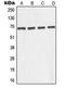 G Protein Nucleolar 1 (Putative) antibody, LS-C352251, Lifespan Biosciences, Western Blot image 