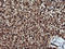Protein Tyrosine Kinase 2 antibody, LS-C788085, Lifespan Biosciences, Immunohistochemistry paraffin image 