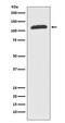 ATP-binding cassette sub-family F member 1 antibody, M05358, Boster Biological Technology, Western Blot image 