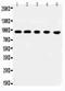 MCC Regulator Of WNT Signaling Pathway antibody, PA2301, Boster Biological Technology, Western Blot image 