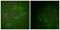 Erb-B2 Receptor Tyrosine Kinase 3 antibody, PA5-38499, Invitrogen Antibodies, Immunofluorescence image 