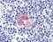 Fc Fragment Of IgE Receptor II antibody, 51-340, ProSci, Immunohistochemistry paraffin image 