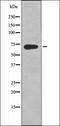 Protein Kinase AMP-Activated Non-Catalytic Subunit Beta 1 antibody, orb335698, Biorbyt, Western Blot image 