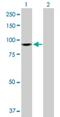 Zw10 Kinetochore Protein antibody, H00009183-D01P, Novus Biologicals, Western Blot image 
