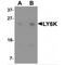Lymphocyte Antigen 6 Family Member K antibody, MBS150777, MyBioSource, Western Blot image 