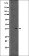 General Transcription Factor IIH Subunit 4 antibody, orb337653, Biorbyt, Western Blot image 