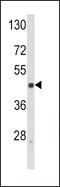 Selectin L antibody, MBS9205262, MyBioSource, Western Blot image 