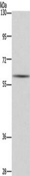 Glutamate Decarboxylase 1 antibody, TA350677, Origene, Western Blot image 