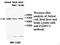 Polyadenylate-binding protein 3 antibody, MBS416604, MyBioSource, Western Blot image 