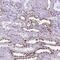POU Class 3 Homeobox 3 antibody, HPA067151, Atlas Antibodies, Immunohistochemistry frozen image 