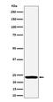 Deoxythymidylate Kinase antibody, M12209-1, Boster Biological Technology, Western Blot image 