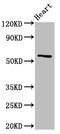 Cytochrome P450 2A6 antibody, LS-C674001, Lifespan Biosciences, Western Blot image 