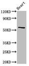 Cytochrome P450 Family 2 Subfamily A Member 6 antibody, LS-C674001, Lifespan Biosciences, Western Blot image 