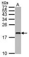 Ubiquitin Conjugating Enzyme E2 V2 antibody, PA5-30994, Invitrogen Antibodies, Western Blot image 