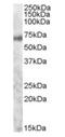 MYB Proto-Oncogene, Transcription Factor antibody, orb19550, Biorbyt, Western Blot image 