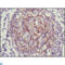 Neurotrophic Receptor Tyrosine Kinase 3 antibody, LS-C812380, Lifespan Biosciences, Immunohistochemistry paraffin image 