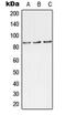 Tousled Like Kinase 1 antibody, MBS821788, MyBioSource, Western Blot image 