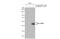 CD209 Molecule antibody, GTX135602, GeneTex, Western Blot image 